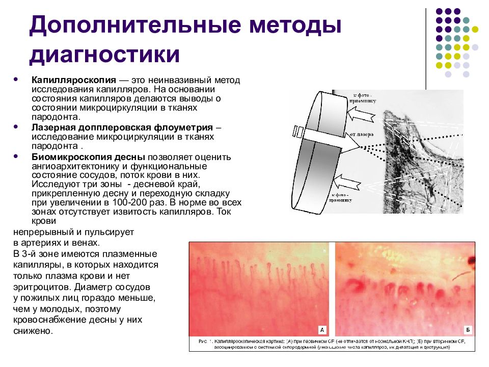 Капилляроскопия