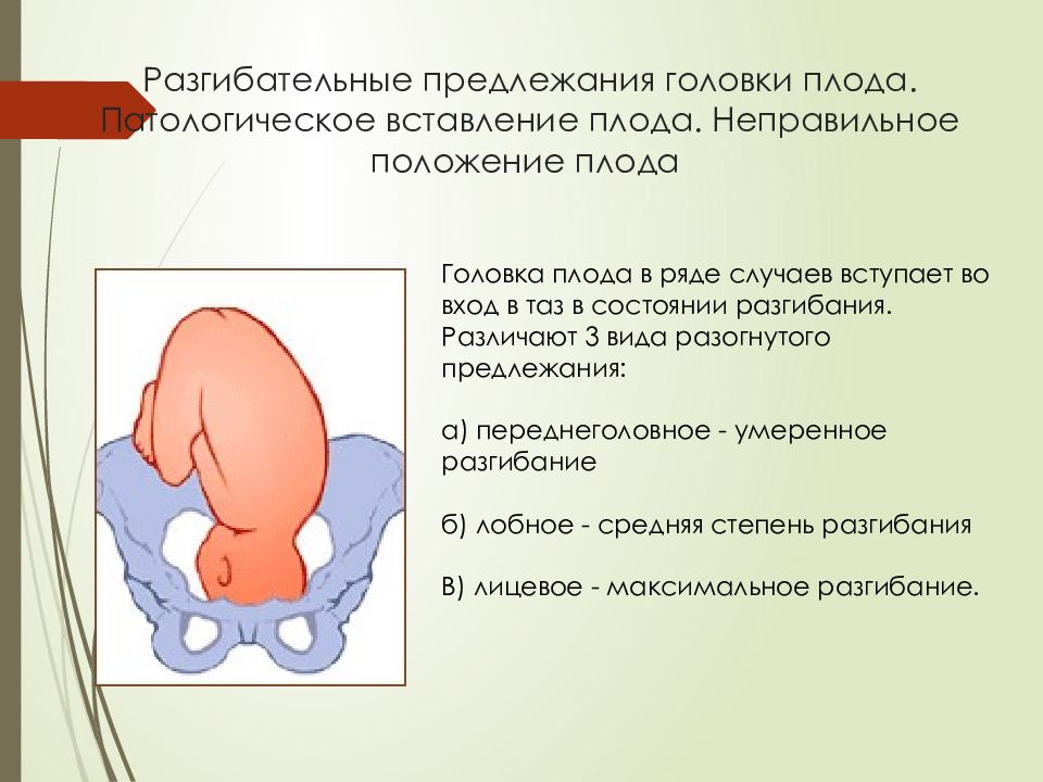 Презентация головка плода