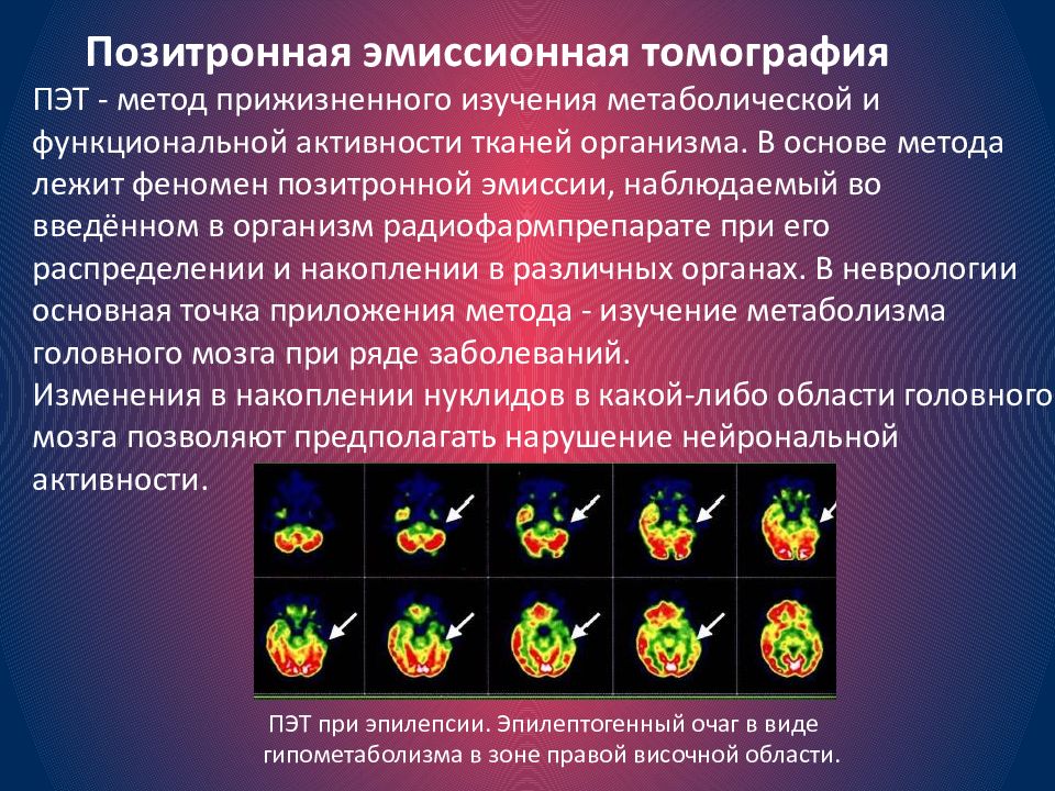 Методы исследования в неврологии презентация