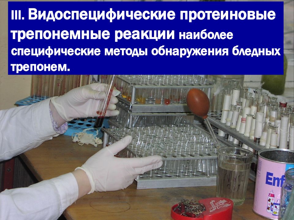 в настоящее время методы специфической