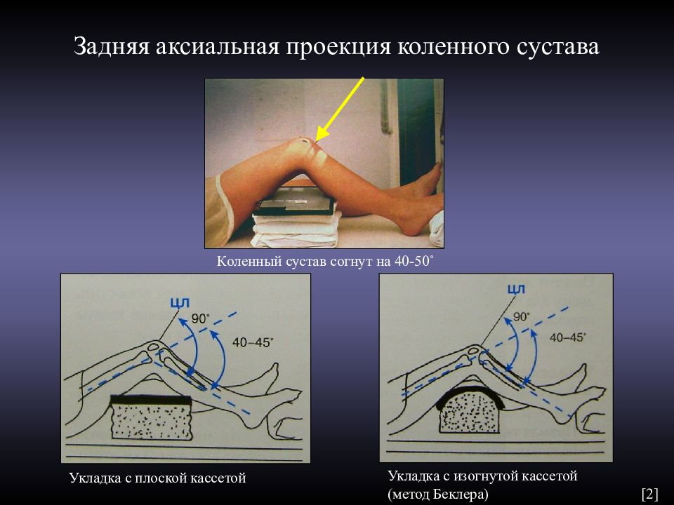 Аксиальная проекция. Аксиальная проекция коленного сустава. Тангенциальная проекция коленного сустава. Акчиальная проекция коленного сустав. Укладка надколенника в аксиальной проекции.