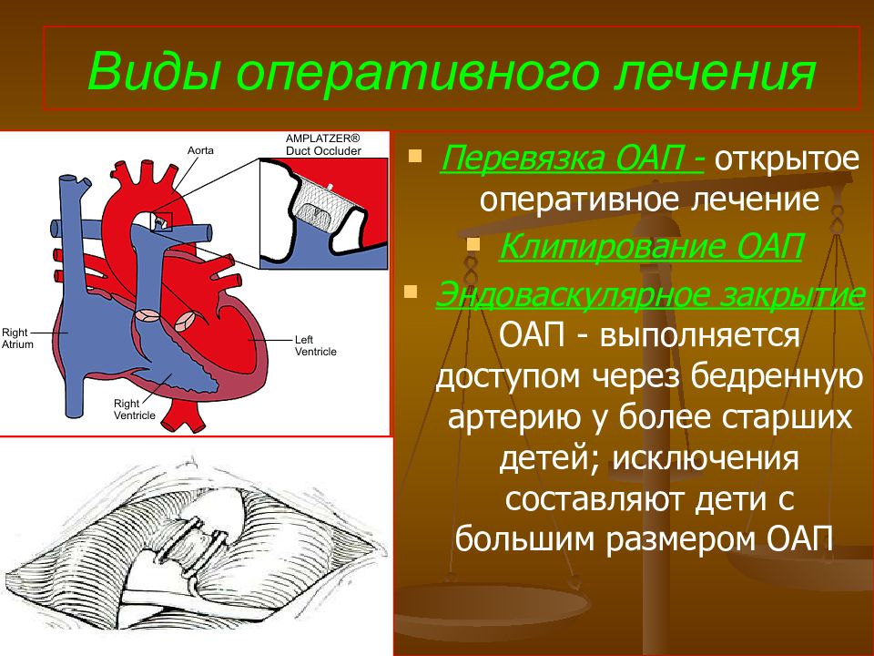 Открытый артериальный проток презентация