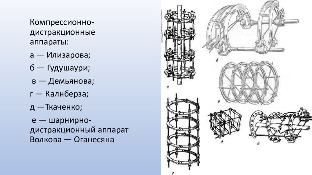 Аппарат илизарова презентация