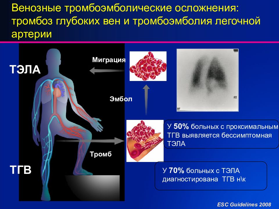 Тромбозы и эмболии артерий. Венозные тромбоэмболические осложнения. Тромбоэмболия легочной артерии.