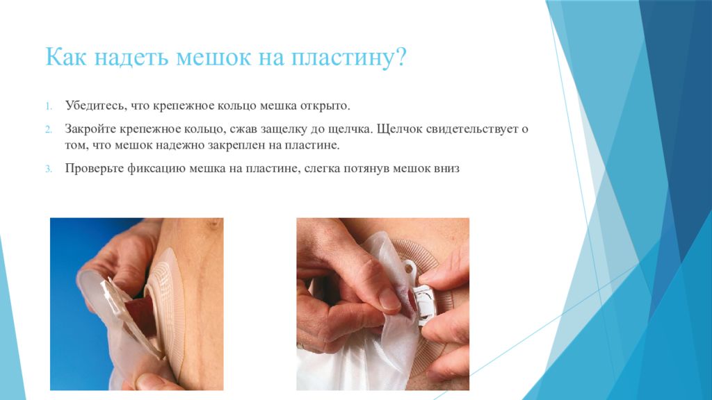 Мешочек калоприемник. Как одевать мешок. Пластиковый пакет в руке. Как надеть мешок на пластину. Надевание мешка пластины.