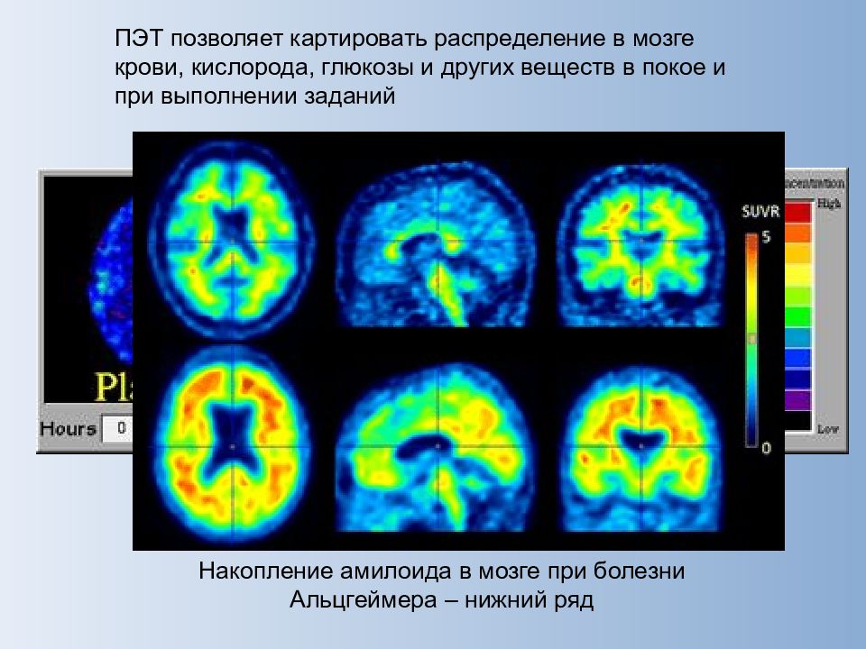 Методы исследования нервной системы у спортсменов презентация