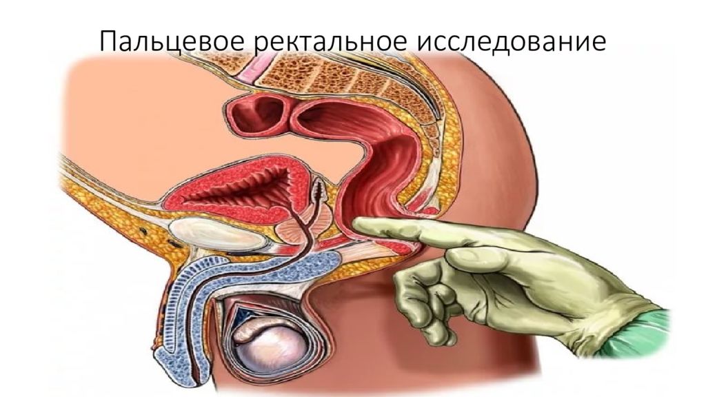 Простата на схеме