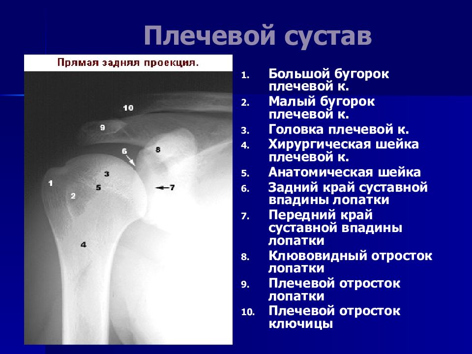 Бугорок плечевой кости. Плечевая кость рентгеноанатомия. Рентгеноанатомия плечевого сустава. Уплотнение головки плечевой кости. Плечевая кость анатомия рентген.