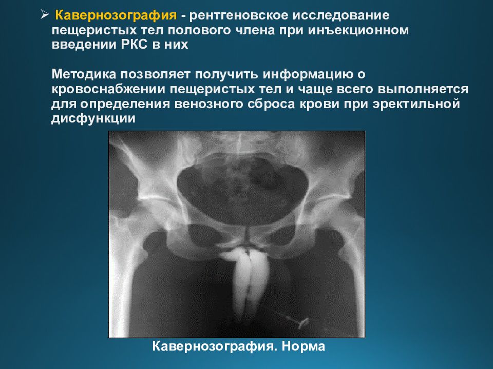 Пещеристое тело. Рентгенологическое исследование женских половых органов. Лучевые исследования половых органов. Методы исследования мужской репродуктивной системы.