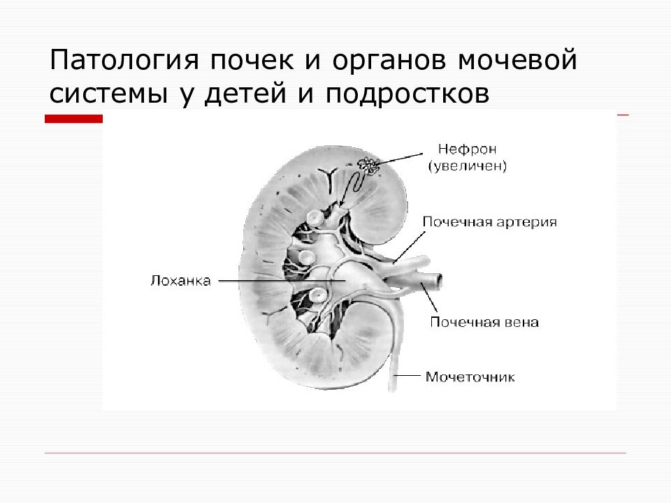 Патология почек. Патологии мочевой системы у детей. Система почек патология.