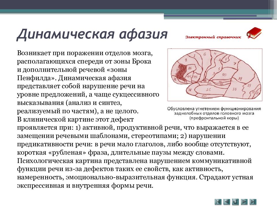 Динамическая афазия картинка