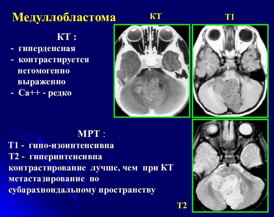 Чем отличаются мрт. Мрт и кт отличия. Различия кт и мрт. Кт и мрт снимки отличия. Различия между кт и мрт.