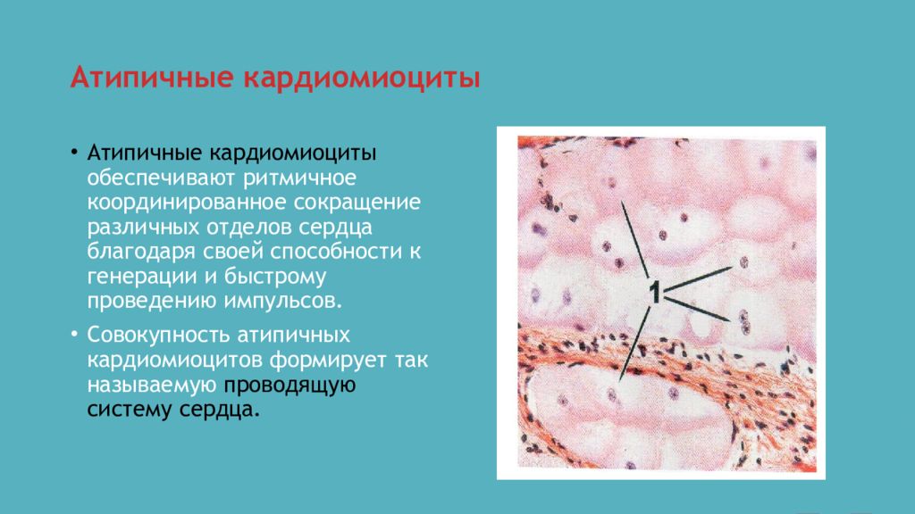 Атипичные кардиомиоциты рисунок