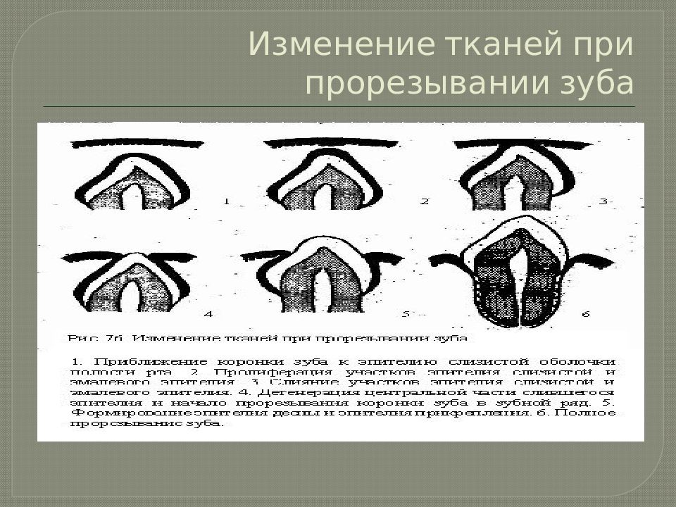 Изменение тканей. Изменения тканей при прорезывании зуба.. Факторы влияющие на прорезывание и формирование временных зубов. Формирование контура прорезывания.