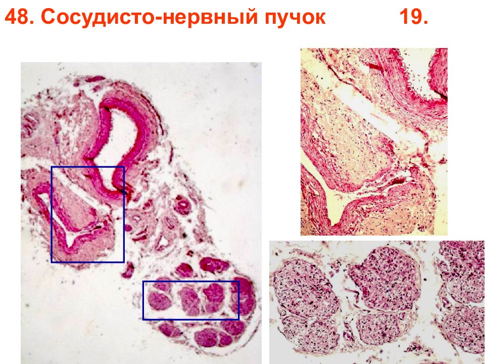 Сосудисто нервный пучок. Нервно сосудистый пучок гистология препарат. Сосудисто нервный пучок гистология препарат. Нервный пучок гистология препарат. Сосуды гистология препарат.