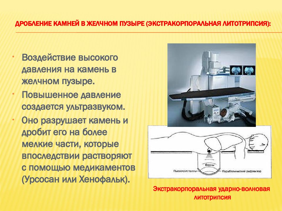 Сестринский уход при желчнокаменной болезни презентация