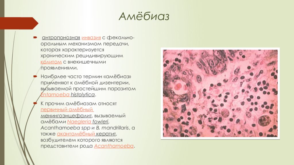 Заболевания вызванные амебами. Дизентерийная амеба возбудитель. Амебиаз (дизентерийный амебиаз). Патогенетическая терапия амебиаза. Дизентерийная амеба клиника.