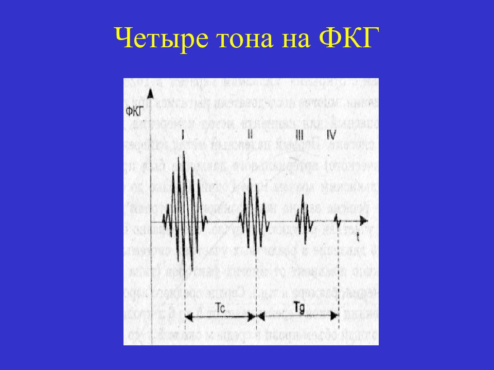 Графическое изображение тонов сердца