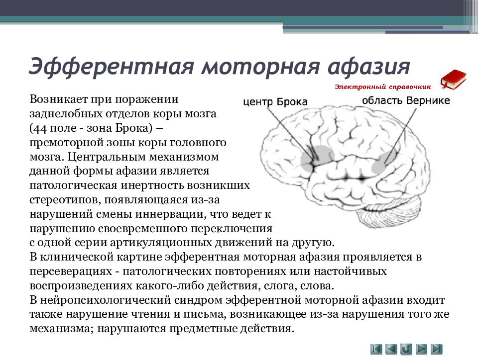 Поражения корково мозга. Афазия Брока локализация. Локализации поражения головного мозга при афазии. Моторная афазия Брока. Моторная Эфферентная афазия Брока локализация.