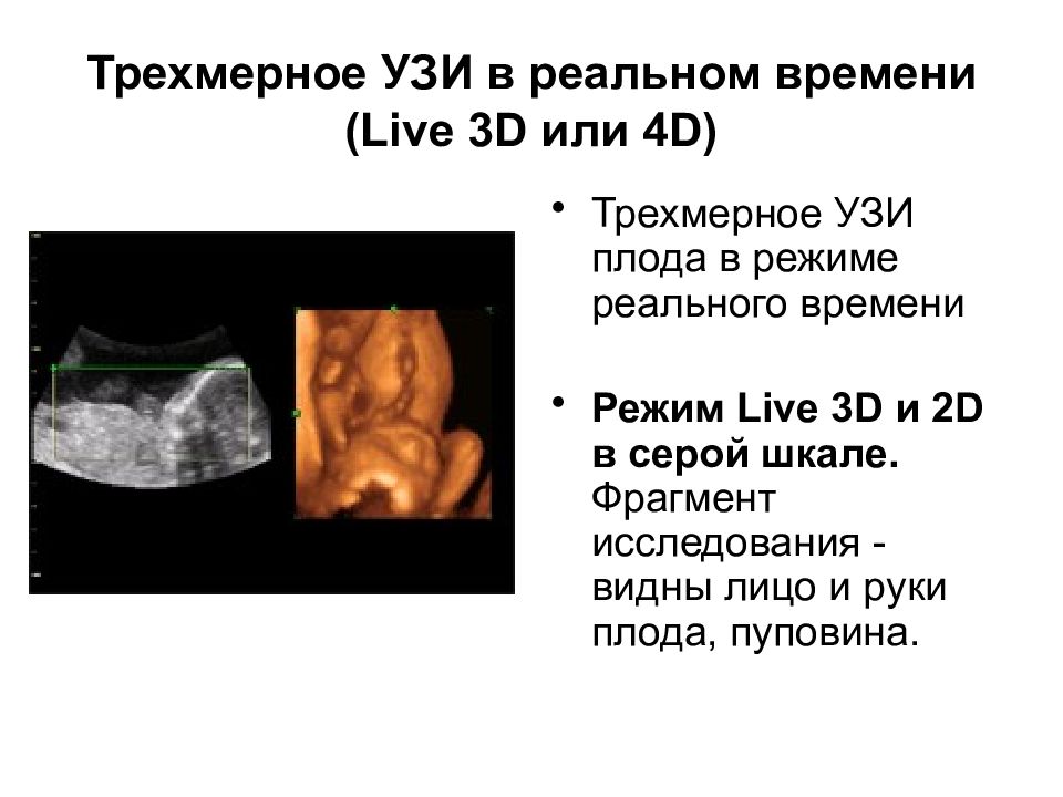 Презентация на тему узи