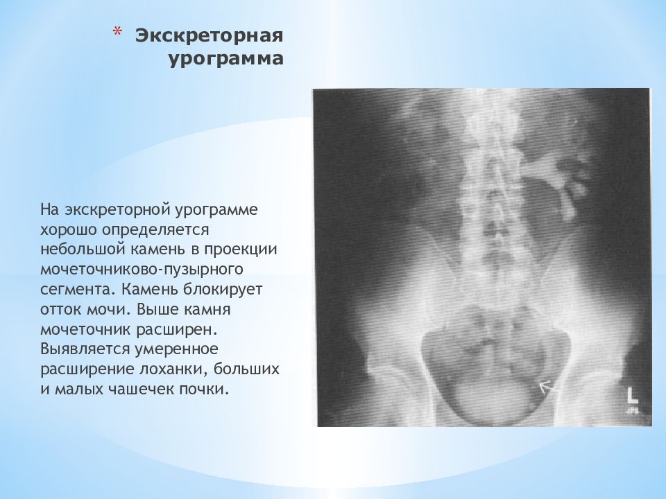 Лучевая диагностика почек презентация