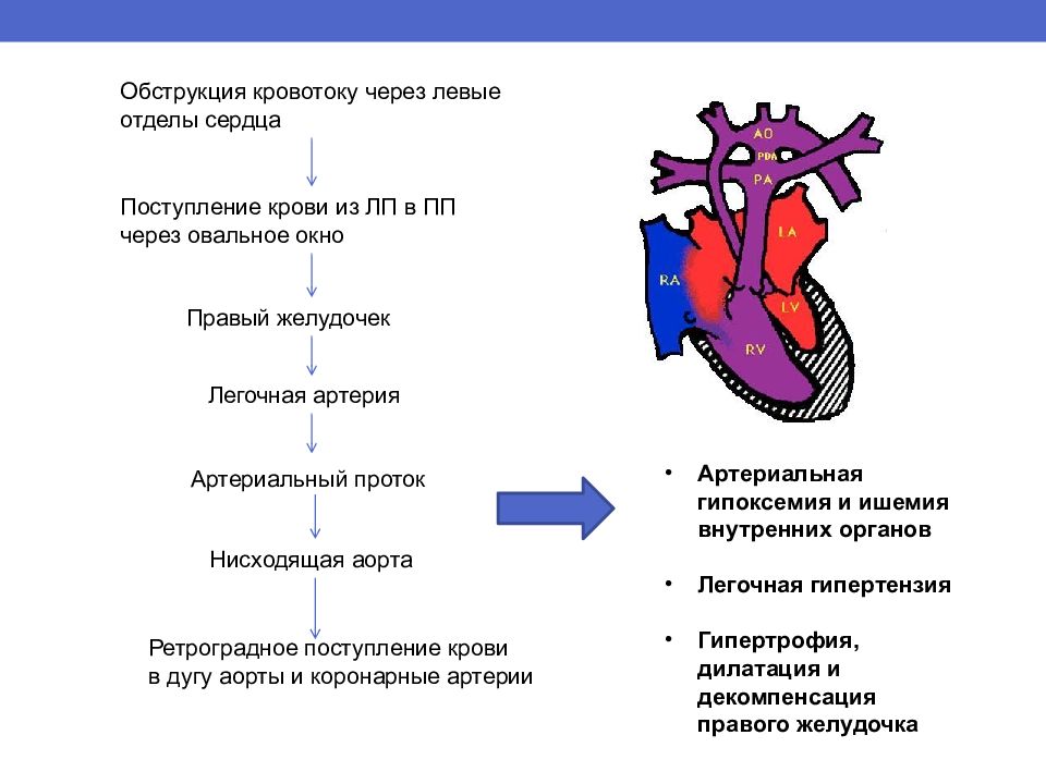 Пороки сердца схема