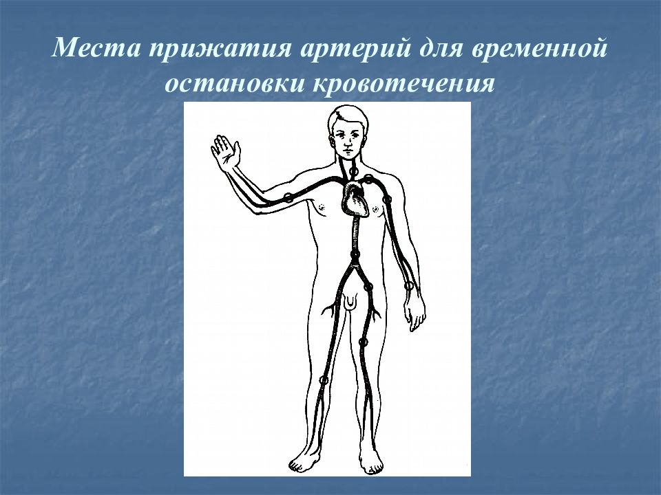 Точки кровотечения. Места прижатия артерий для временной остановки кровотечения. Места прижатия артерий. Места прижатия артерий для временной остановки. Точки пальцевого прижатия артерий для остановки.