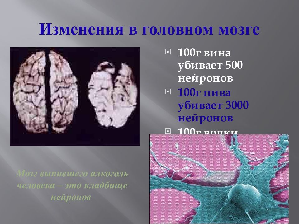 Головной мозг пьющего. Влияние табакокурения на головной мозг. Влияние спиртов на головной мозг. Головной мозг алкоголика.