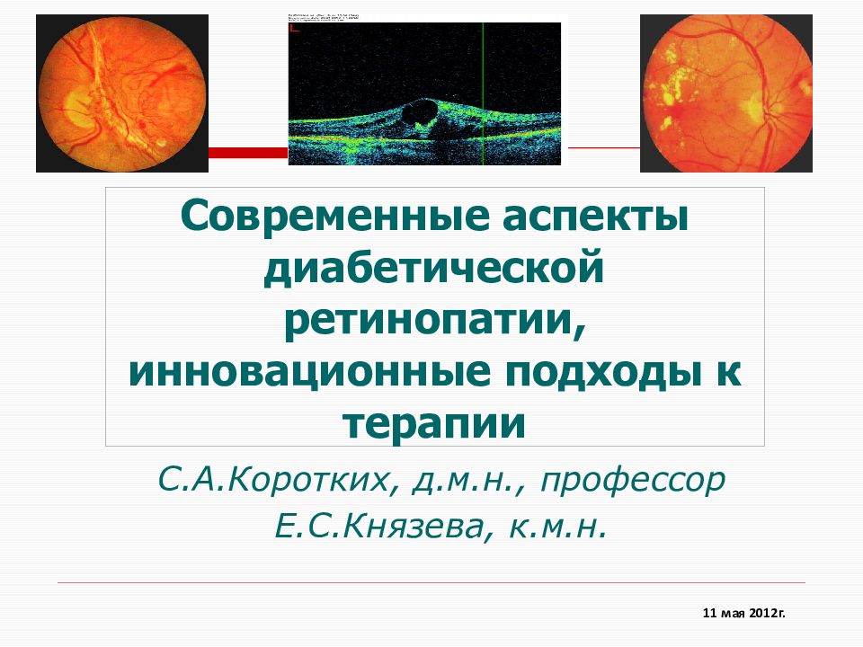 Современные аспекты. Диабетическая ретинопатия презентация. Современные аспекты это. Препараты при диабетической ретинопатии. Современный.