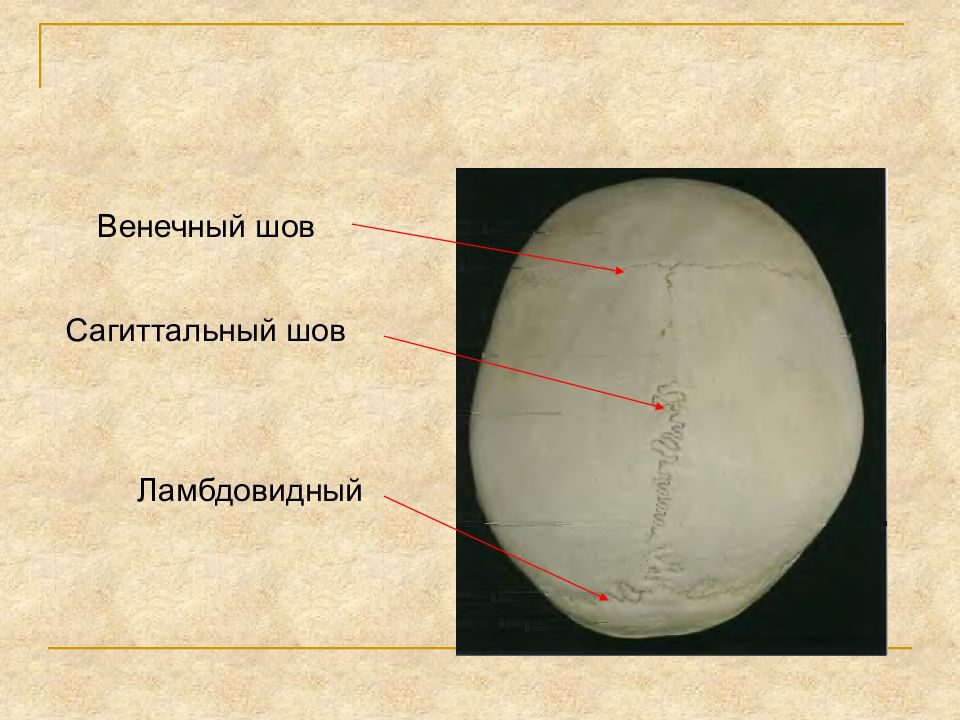 Стреловидный шов фото