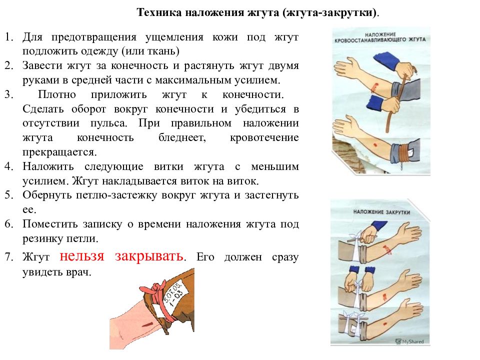 Временный прием