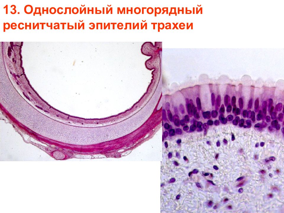 Трахею выстилает эпителий. Многорядный реснитчатый мерцательный эпителий. Однослойный многорядный мерцательный эпителий препарат. Многорядный призматический мерцательный эпителий. Многорядный призматический реснитчатый эпителий.