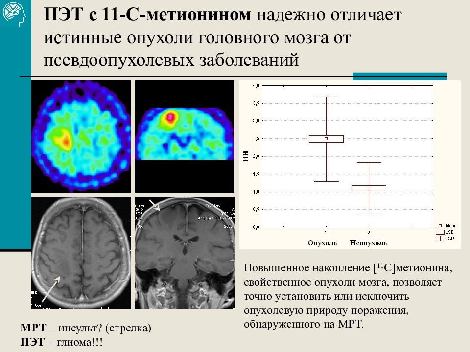 Метаболическая магнитно резонансная томограмма относится к функциональным изображениям