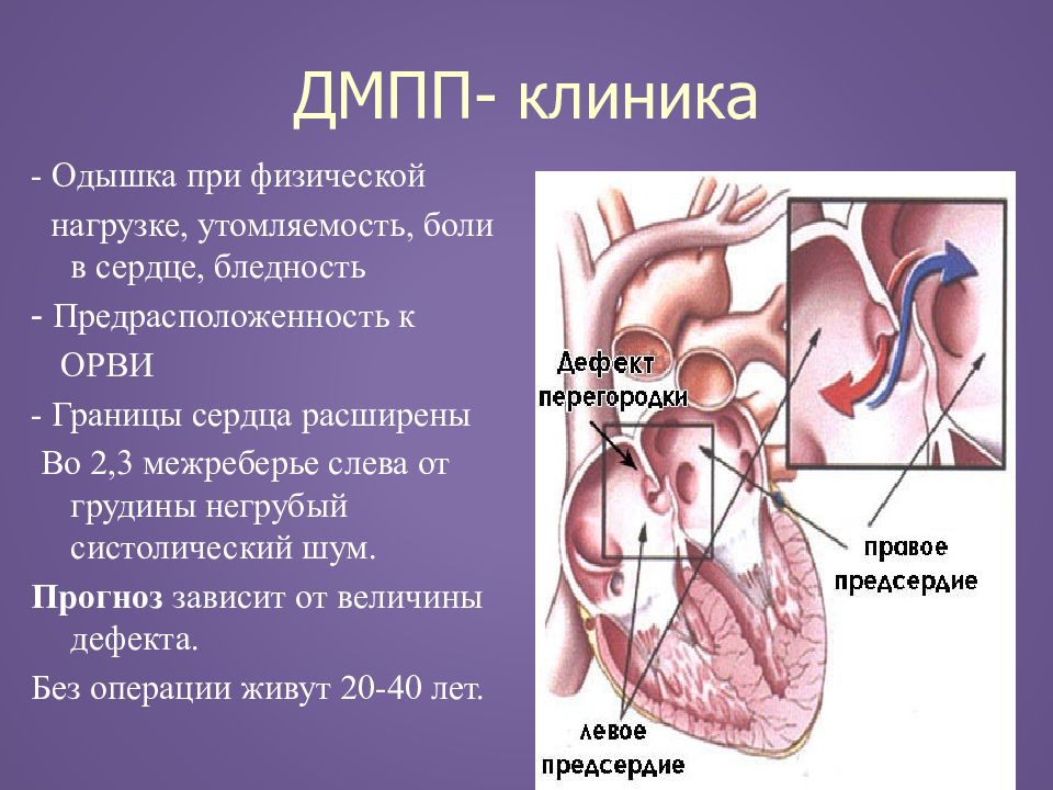 Презентация пороки сердца у беременных презентация