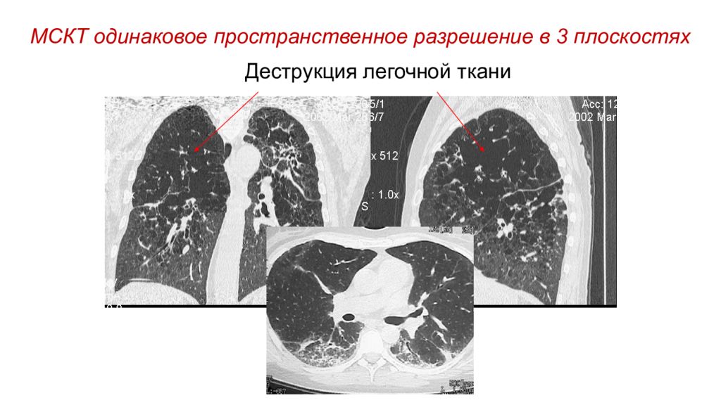 Формирование кт изображений основано на