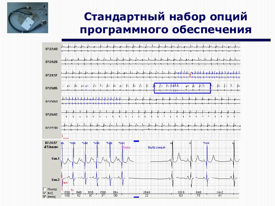 Дневник при холтеровском мониторировании образец как