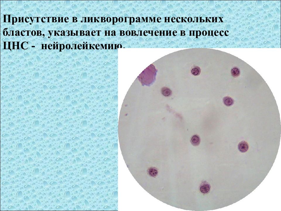 Исследование ликвора презентация