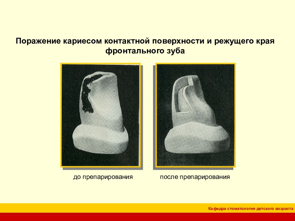 4 класс по блэку презентация