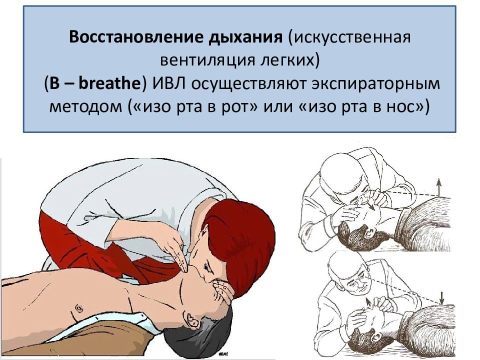 Изучение и освоение основных способов искусственного дыхания презентация