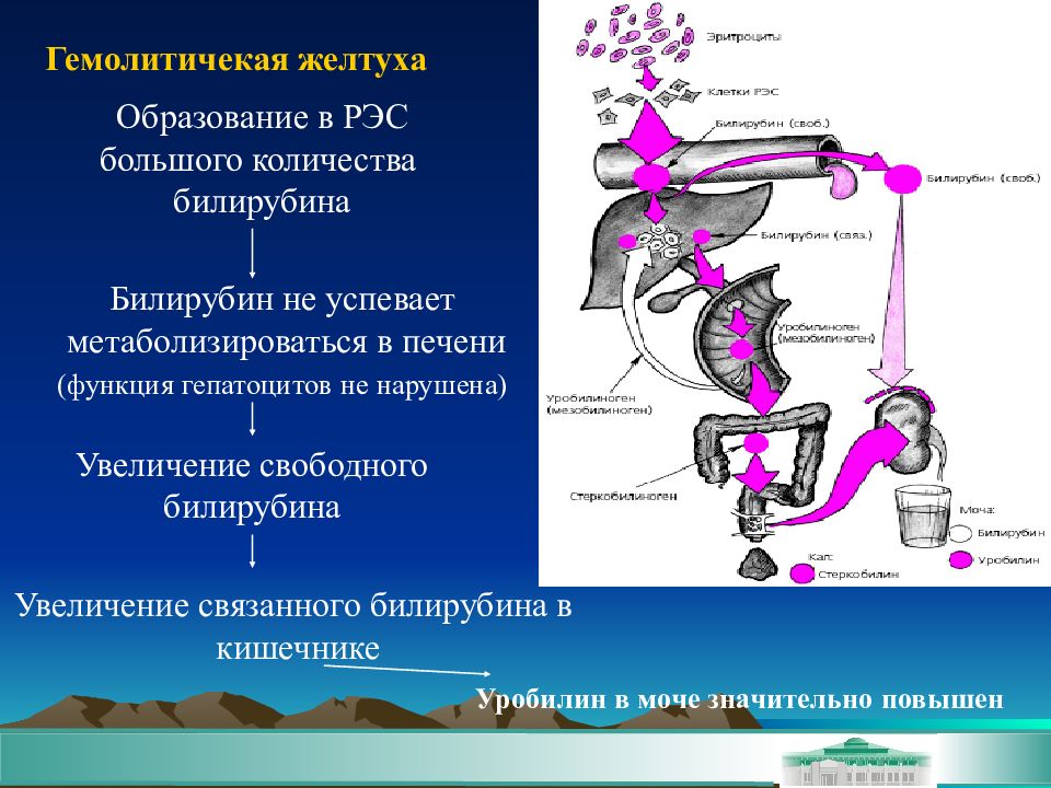 Патогенез механической желтухи схема