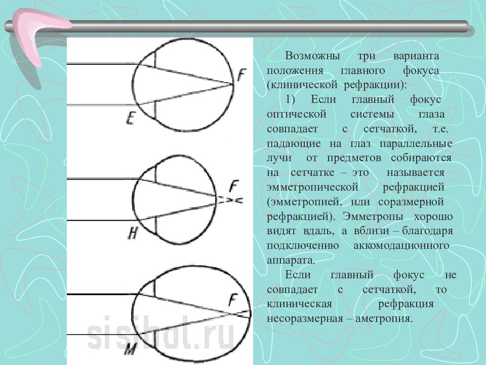 Аккомодация глаза рисунок