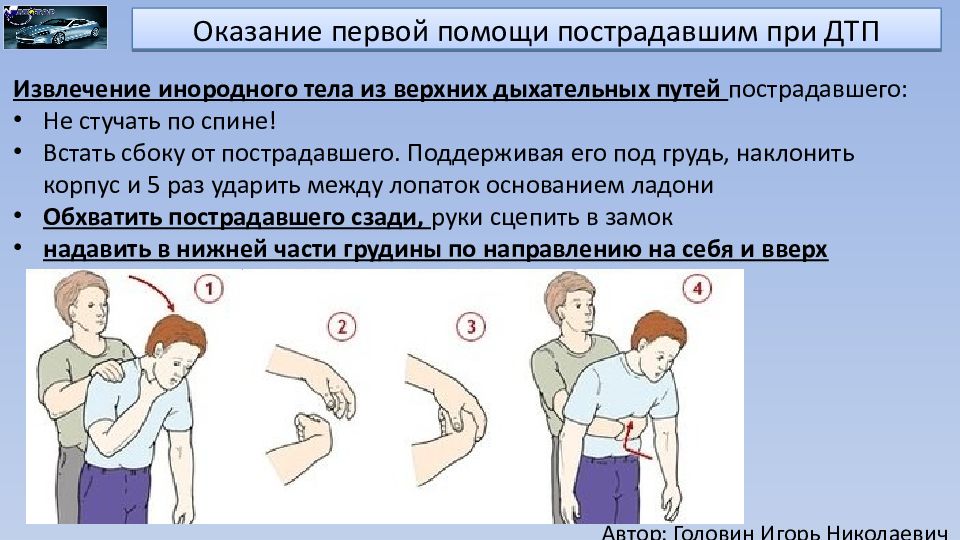 Каких либо повреждений. Алгоритм оказания первой помощи при ДТП. Оказание 1 помощи пострадавшему при ДТП. Обращение с пострадавшим. Оказание первой помощи пострадавшего при ДТП пострадавшему.