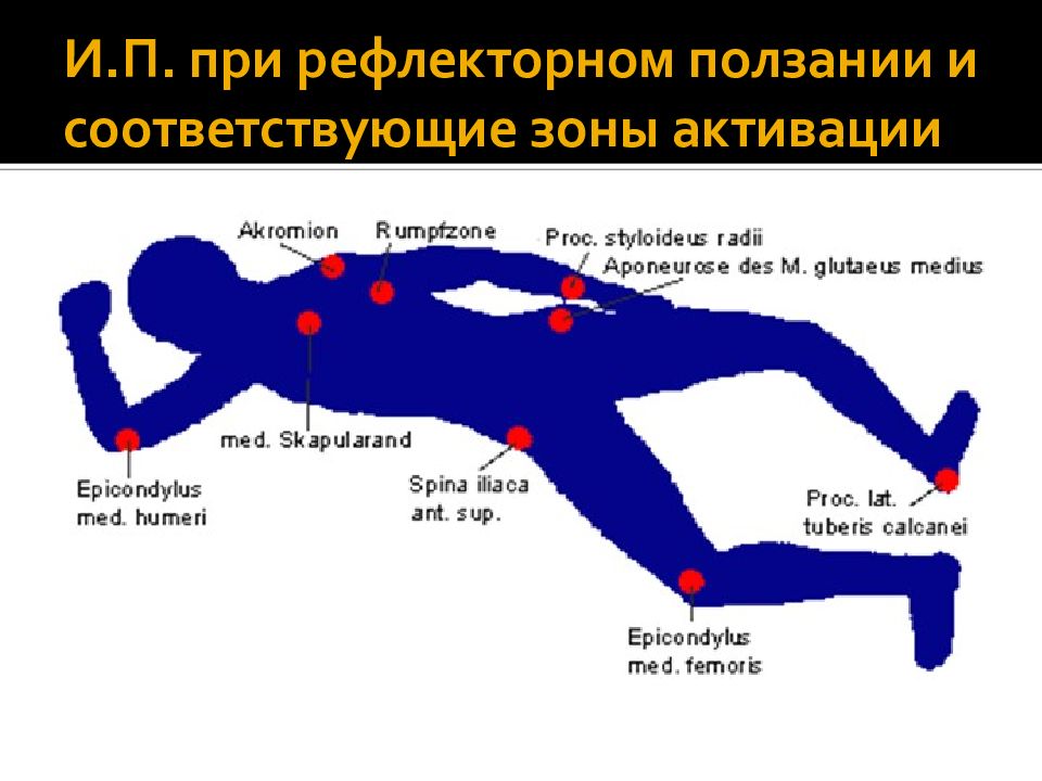 Терапия войта презентация