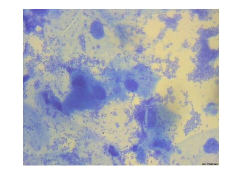 Приготовление бактериального препарата (мазка)