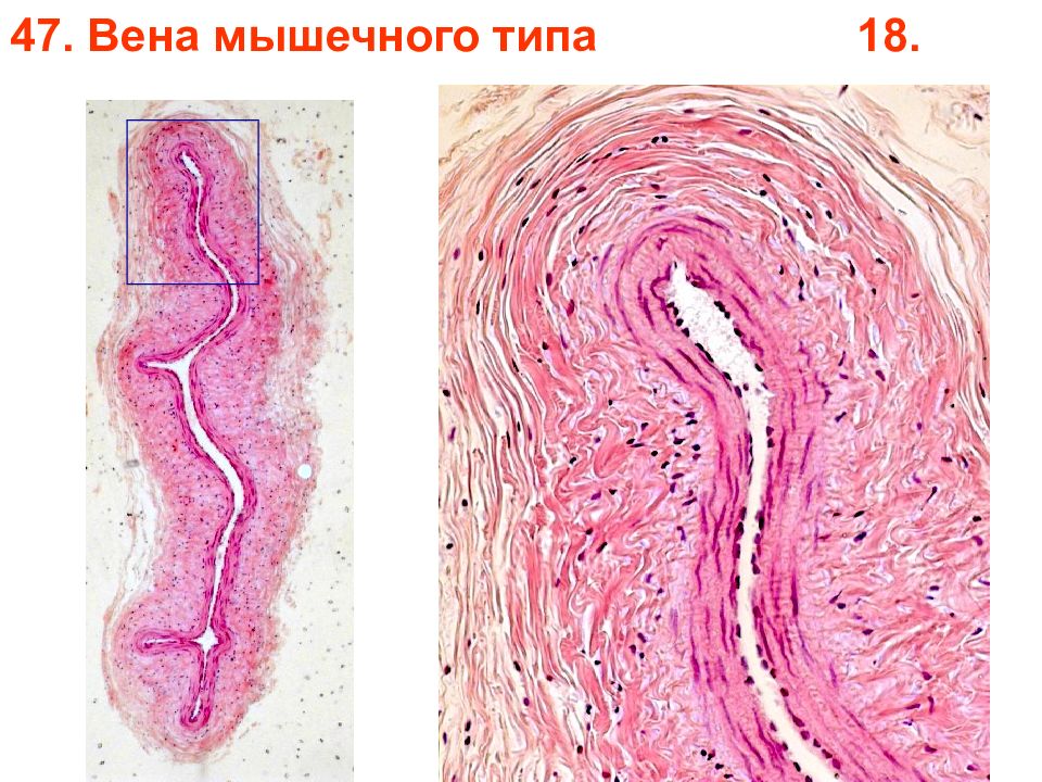 Типа вена. Бедренная Вена препарат гистология. Вена мышечного типа гистология. Вена мышечного типа гистологический препарат. Вена мышечного типа препарат гистология.