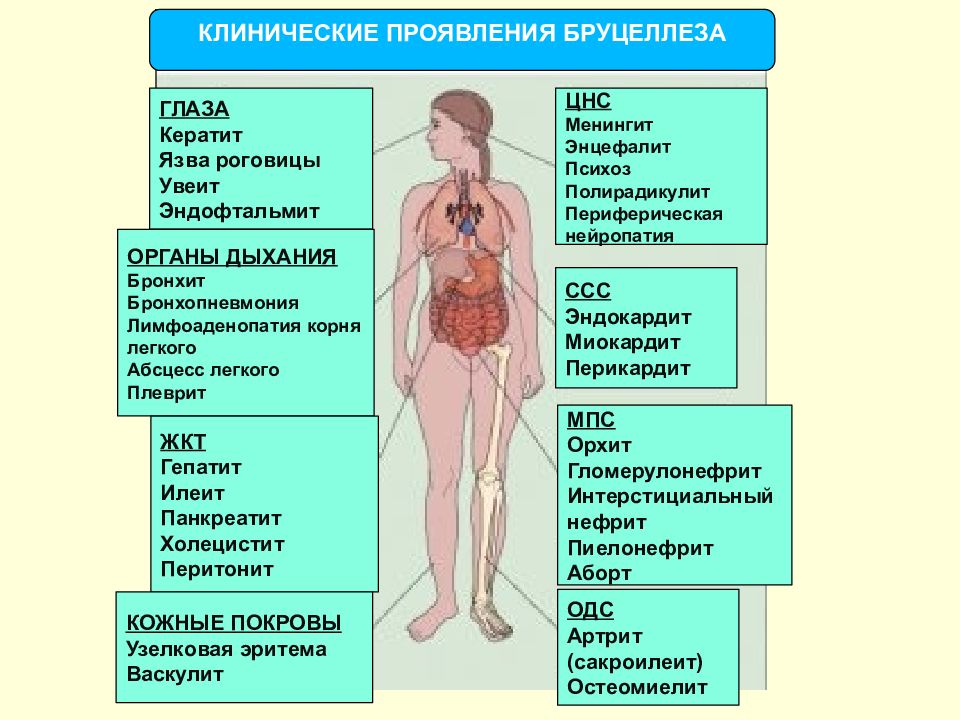 Хронический бруцеллез презентация