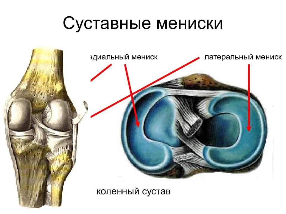 Латеральный разрыв. Строение колена-мениск анатомия. Мениски колена анатомия. Строение сустава с мениском. Мениски коленного сустава анатомия.