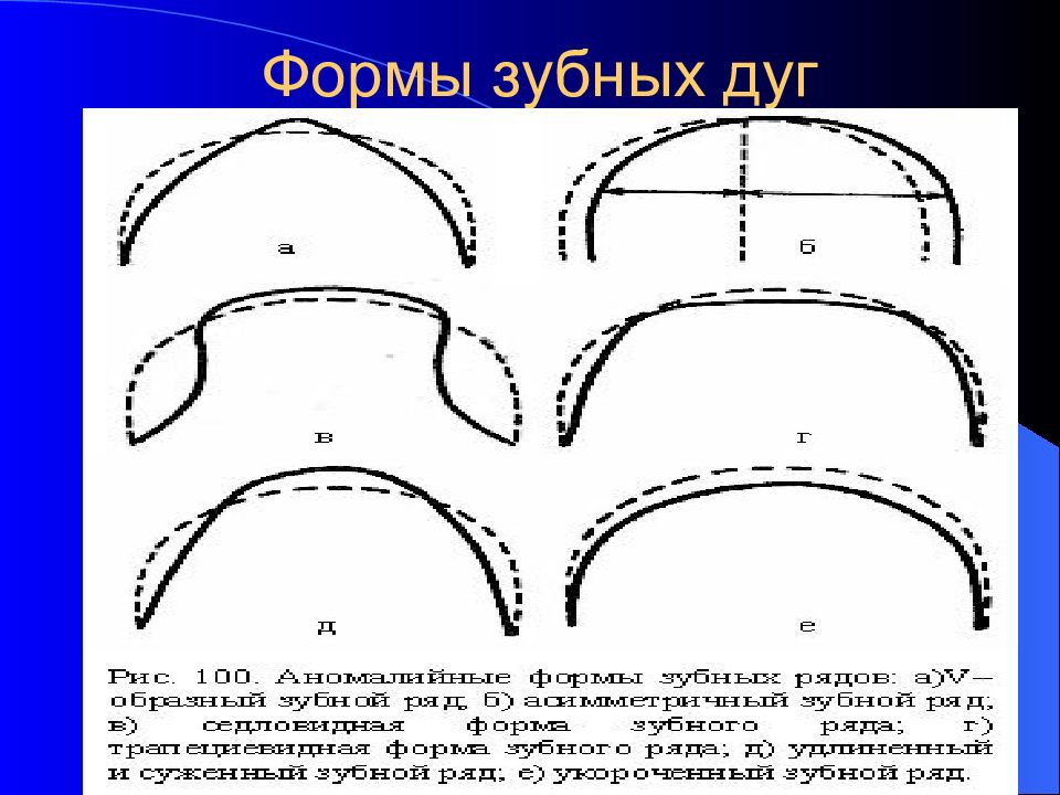 Как нарисовать полуэллипс