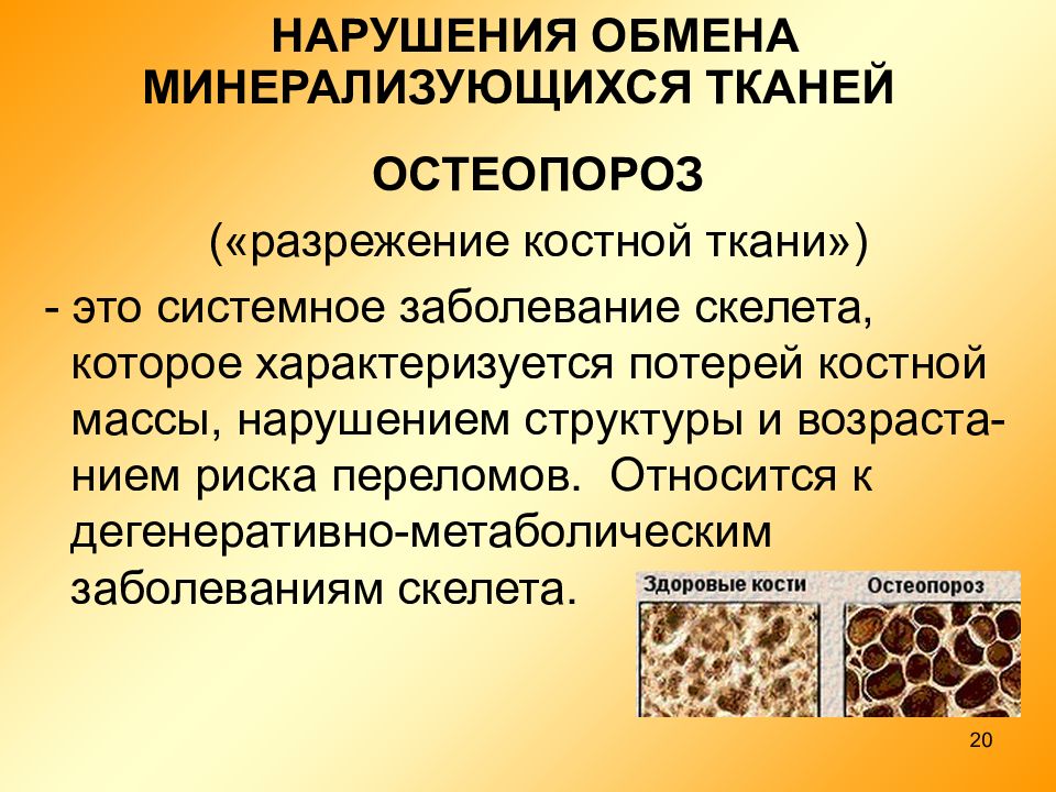 Нарушение тканей. Разрежение костной ткани. Остеопороз разрежение костной ткани. Ремоделирование структуры кости. Ремоделирование костной ткани и нарушения.