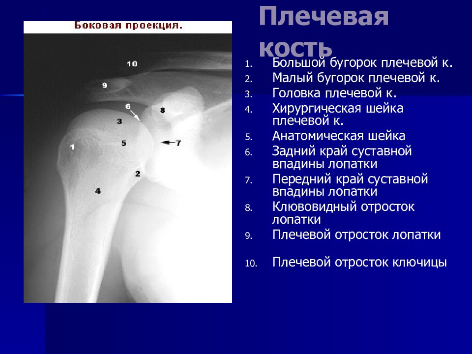 Большой бугорок плечевой кости фото